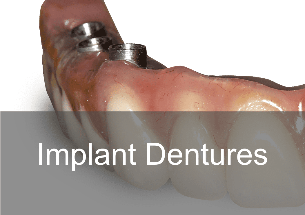 Private Implant Dentures at Swissedent Denture Clinic in London UK