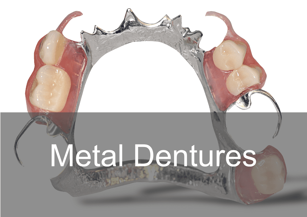 Pirvate Metal Chrome Dentures at Swissedent Denture Clinic in London
