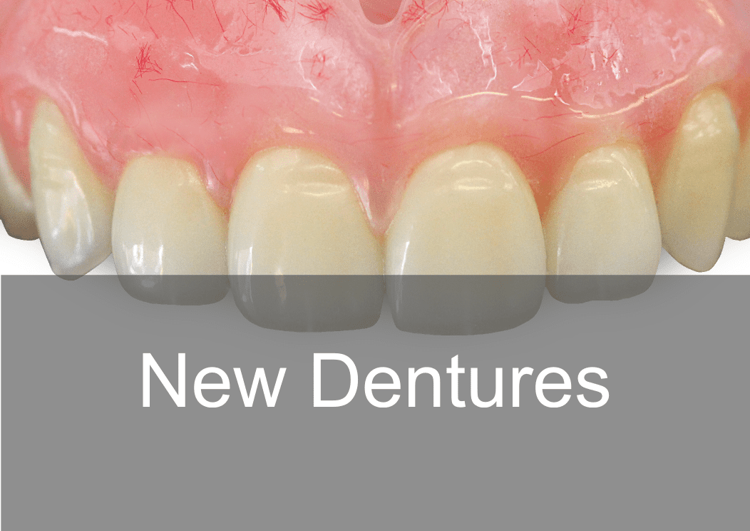 Private Dentures at Swissedent Denture Clinic in London